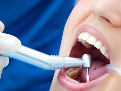 Tratamente endodontice